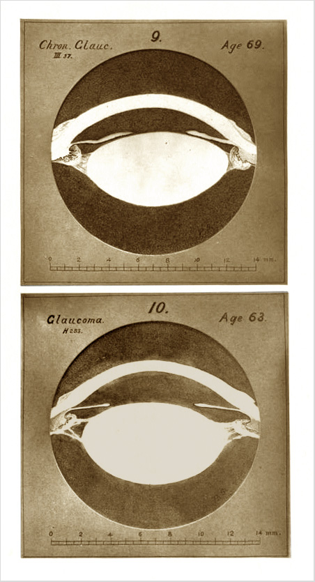 Smith1880-82